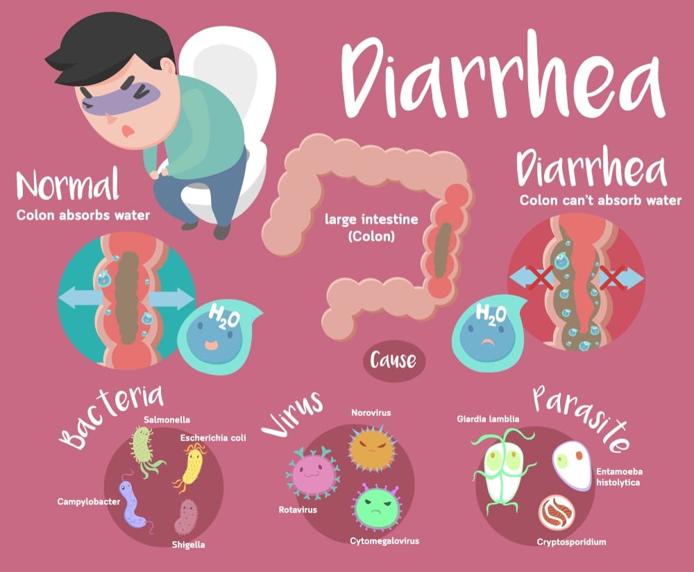 Diarrhea Top Surgeon Dr. Dasari
