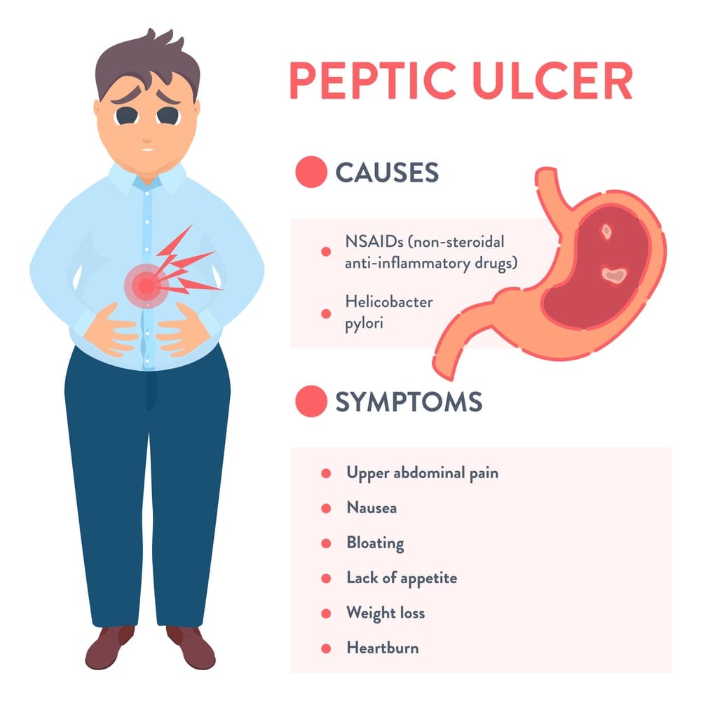 duodenal ulcer pain location